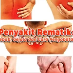 Penyakit Rematik: Penyebab, Gejala dan Cara Pengobatannya