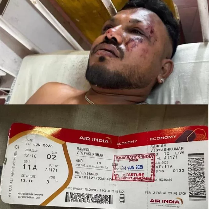 Warga negara Inggris Vishwashkumar Ramesh dari Leicester, yang duduk di kursi 11a, menjadi satu-satunya yang selamat dan hanya mengalami beberapa goresan pada tragedi jatuhnya pesawat Air India.