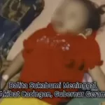 Balita Sukabumi Meninggal Akibat Cacingan, Gubernur Geram