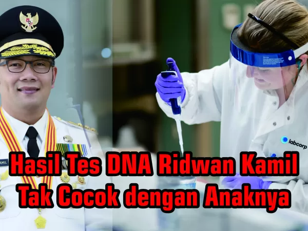 Hasil Tes DNA Ridwan Kamil Tak Cocok dengan Anaknya